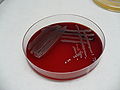 Pseudomonas fluorescens, blood agar, smell with scent of jasmine