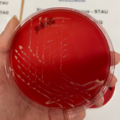Rhodococcus equi, blood agar
