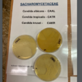 Sacharomycetaceae - yeast