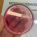 Salmonella enterica, Endo agar