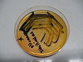 Salmonella enterica enteritidis, thiosulfate-citrate-bile salts-sucrose agar (TCBS)