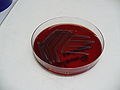 Salmonella enterica enteritidis, blood agar