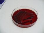 Cultivation of Salmonella Enteritidis on blood agar