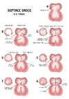 Development of septum and foramen ovale