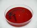 Shigella flexneri, blood agar, detail