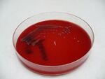 Shigella flexneri - Blood agar