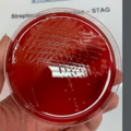 Streptococcus agalactiae, blood agar