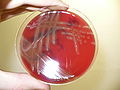 Cultivation of Streptococcus pneumoniae R-phase-detail of hemolysis