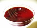 Cultivation of Streptococcus pneumoniae on blood agar, R-phase
