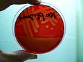 Streptococcus pyogenes, blood agar, β-hemolysis detail