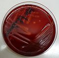 Streptococcus pyogenes on blood agar