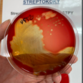 Streptococcus pyogenes, blood agar