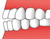 Teeth - hiatodontia.png