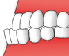 Teeth - prognathodontics.png