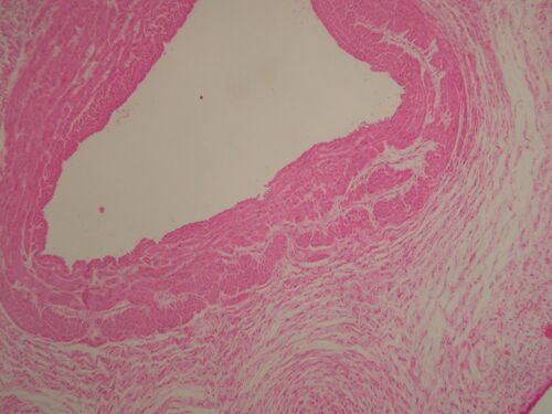 Umbilical vein HE.jpg