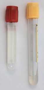Vacuum tubes for serum collection. The tube with the gold cap contains the separation gel.