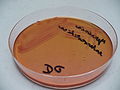 Yersinia enterocolitica, thiosulfate-citrate-bile salts-sucrose agar (TCBS)