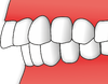 Zuby - opsidodontie.png